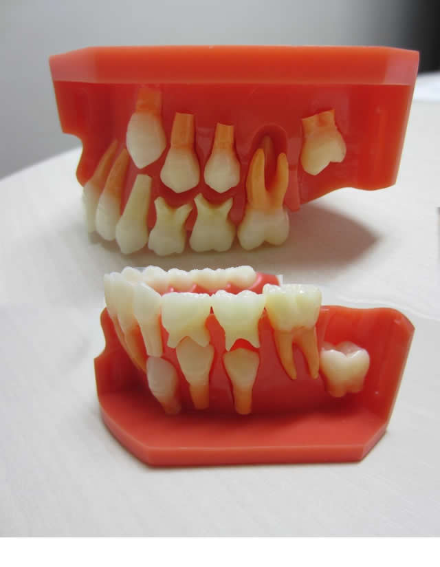 tooth_01