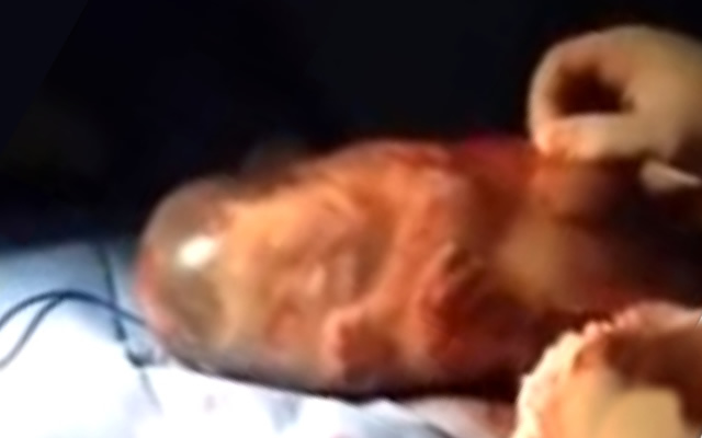 動画 胎児はお腹のなかでこんな風に動いてる 羊膜に包まれて誕生した赤ちゃん まんまみーあ